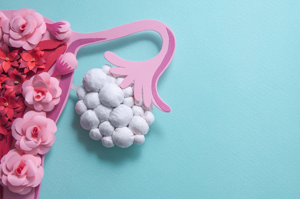 best diet for pcos patients